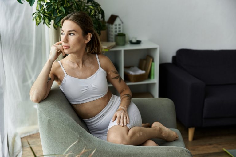 Young woman with vitiligo meditates in modern apartment